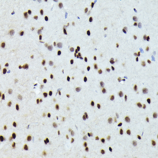Anti-Fos B Rabbit pAb