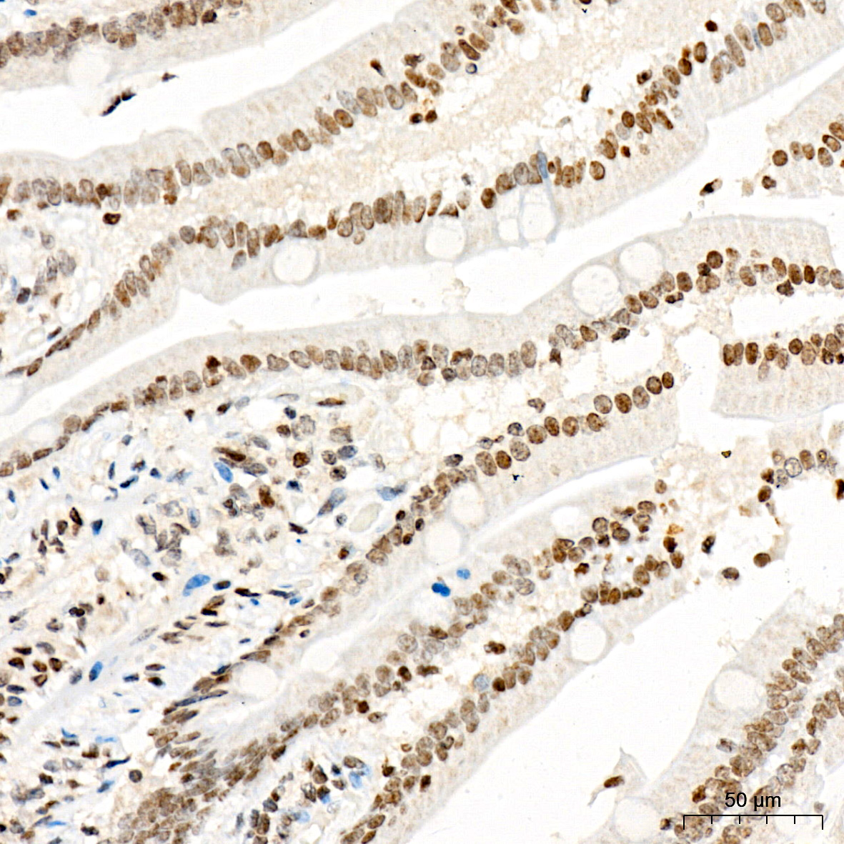 Anti-p21 Rabbit pAb