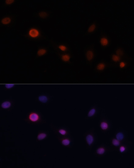 Anti-p21 Rabbit pAb