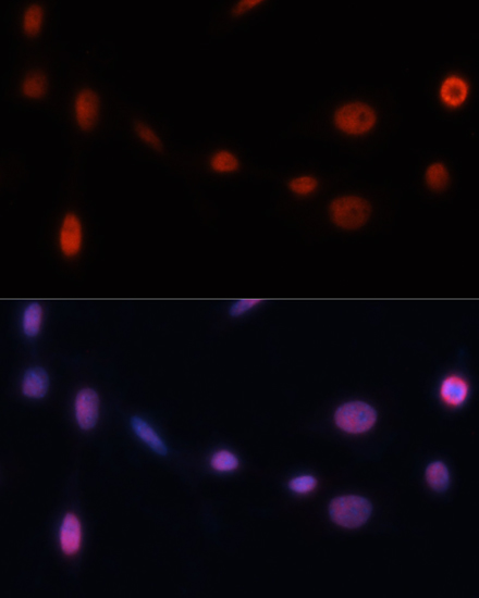 Anti-p21 Rabbit pAb