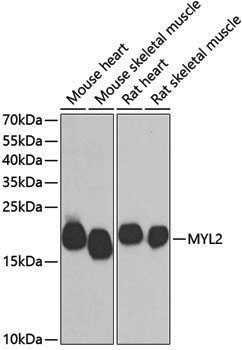 Anti-MYL2 Rabbit pAb