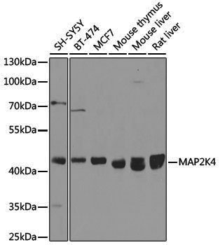 [KO Validated] Anti-MEK4 Rabbit pAb