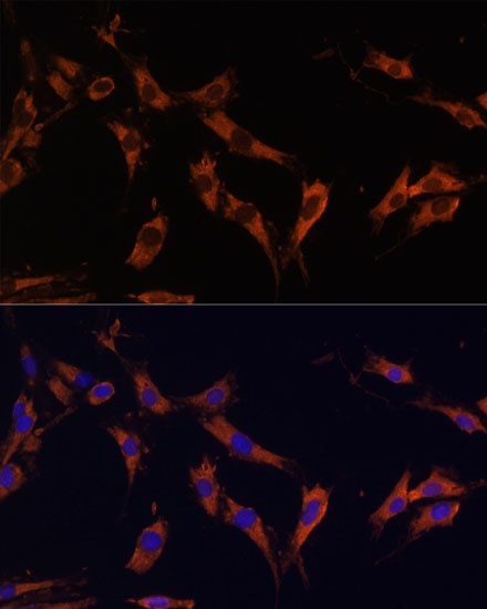 Anti-KSR1 Rabbit pAb