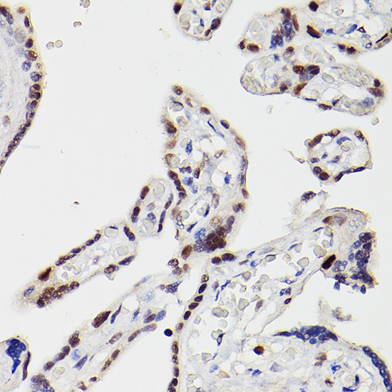Anti-HDAC9 Rabbit pAb