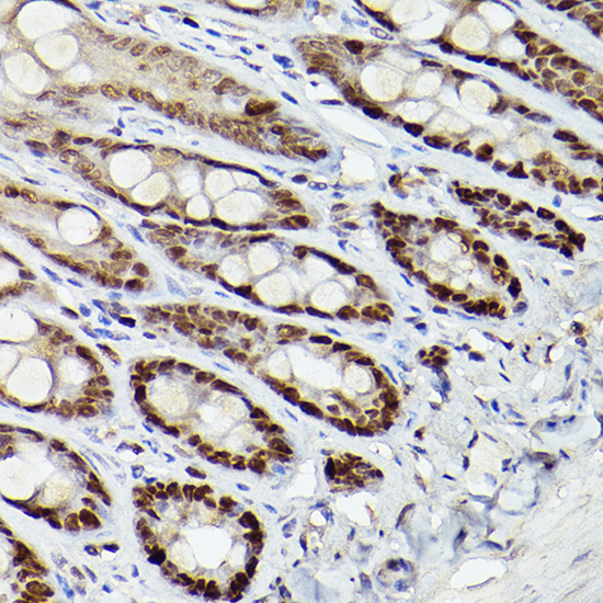 Anti-HDAC9 Rabbit pAb