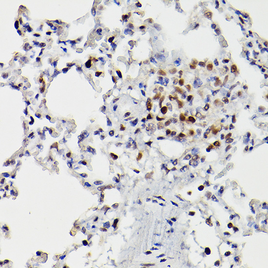 Anti-HDAC9 Rabbit pAb