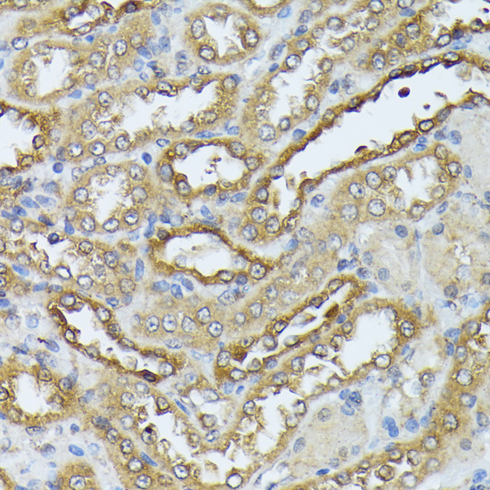 Anti-DAP kinase 3 Rabbit pAb