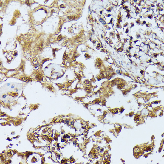 Anti-DAP kinase 3 Rabbit pAb