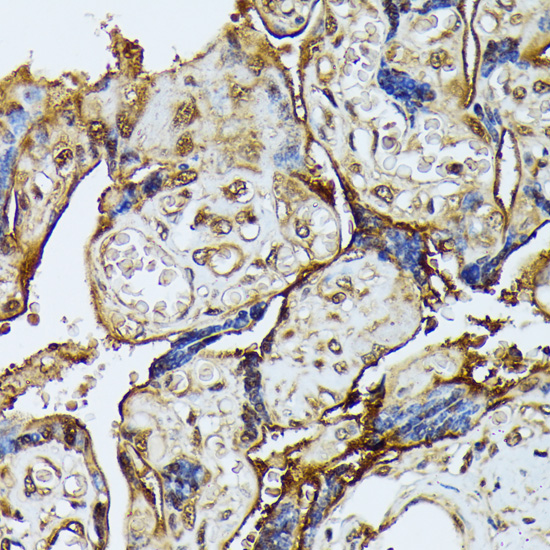 Anti-DAP kinase 3 Rabbit pAb