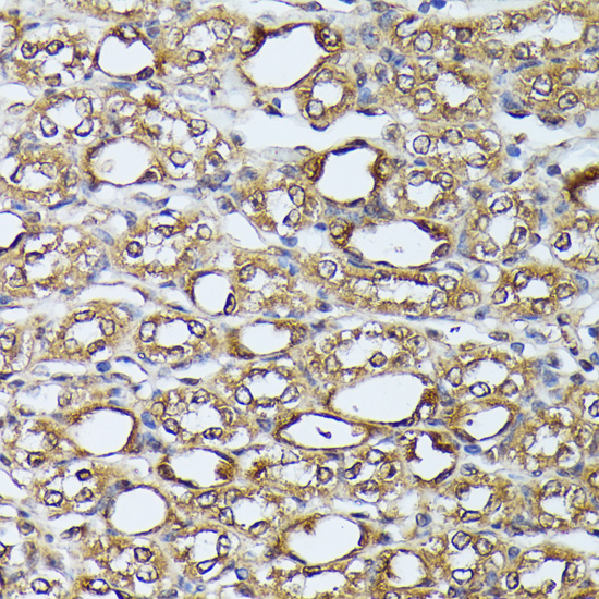 Anti-DAP kinase 3 Rabbit pAb