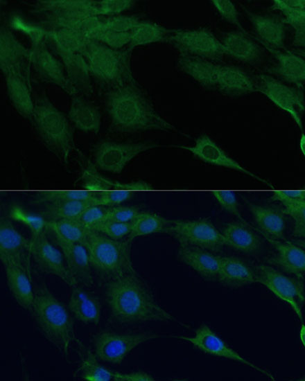 Anti-DAP kinase 3 Rabbit pAb