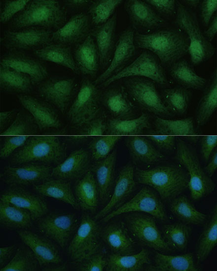 Anti-DAP kinase 3 Rabbit pAb