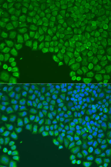 Anti-CDC42 Rabbit pAb