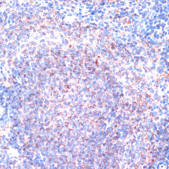 Anti-RSK1 p90 Rabbit pAb