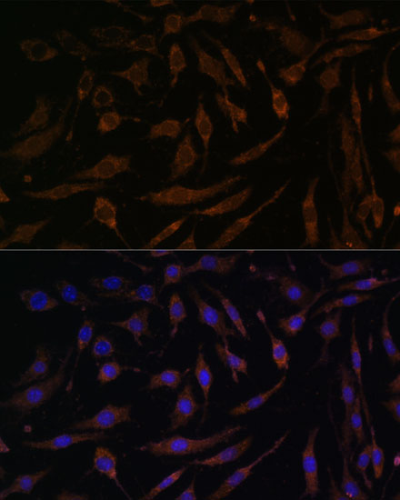 Anti-RSK1 p90 Rabbit pAb