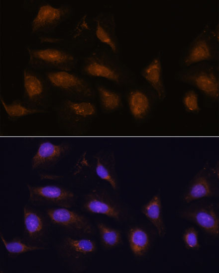 Anti-RSK1 p90 Rabbit pAb