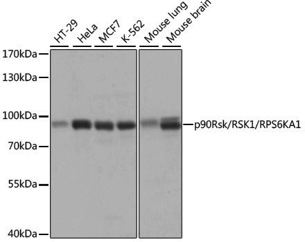 Anti-RSK1 p90 Rabbit pAb
