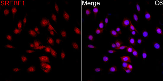 Anti-SREBP1 Rabbit pAb