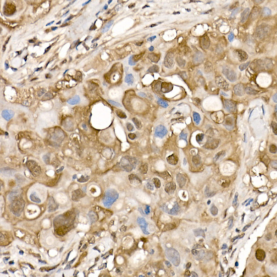 Anti-ATP Citrate lyase Rabbit pAb