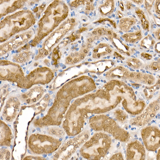Anti-ATP Citrate lyase Rabbit pAb