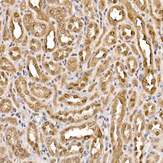 Anti-ATP Citrate lyase Rabbit pAb