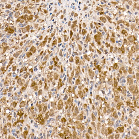 Anti-ATP Citrate lyase Rabbit pAb