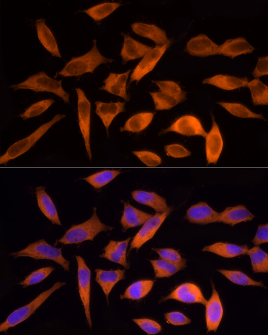 Anti-ATP Citrate lyase Rabbit pAb
