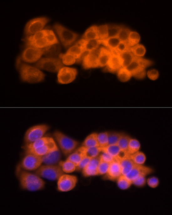 Anti-ATP Citrate lyase Rabbit pAb