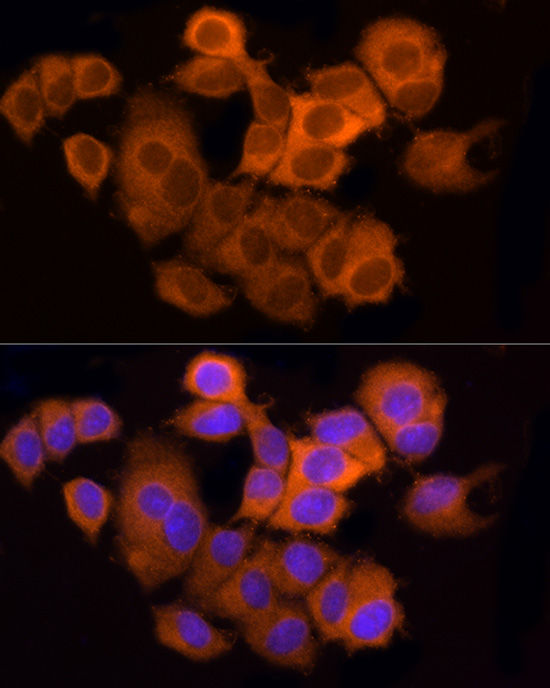Anti-ATP Citrate lyase Rabbit pAb