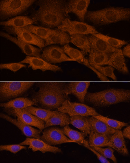 Anti-ATP Citrate lyase Rabbit pAb
