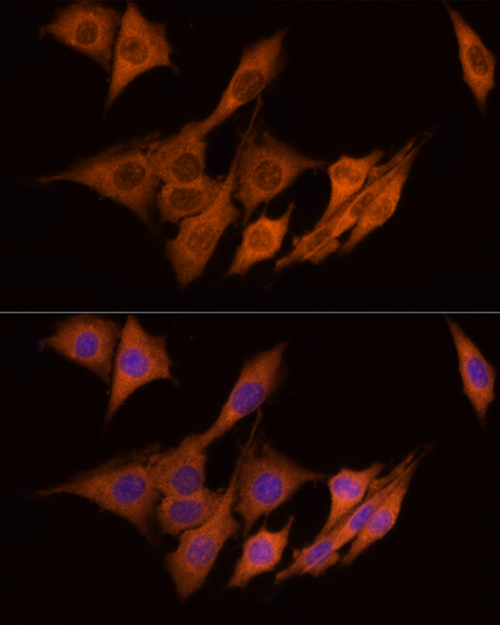 Anti-ATP Citrate lyase Rabbit pAb