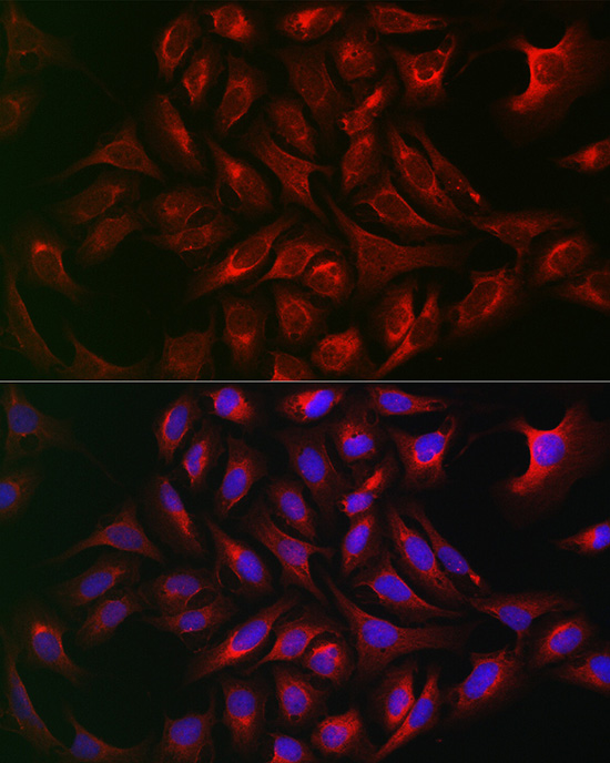Anti-ATG12 Rabbit pAb