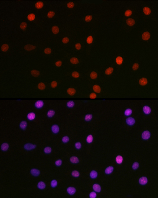 Anti-Acetyl-HMGB1 (Lys29) Rabbit pAb