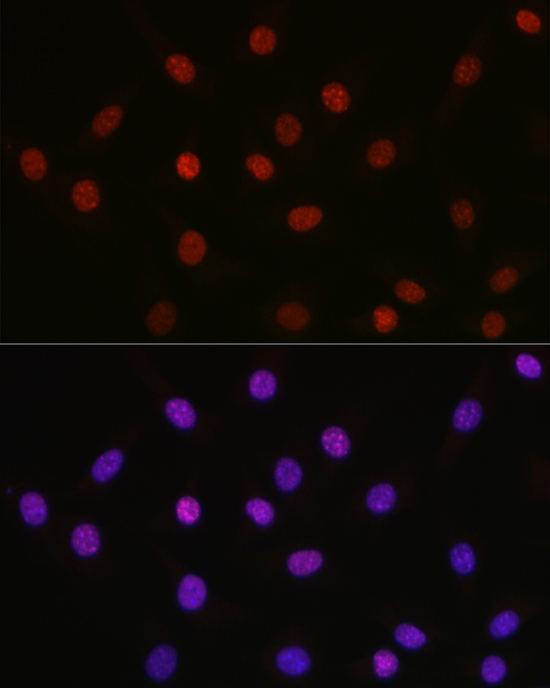 Anti-Acetyl-HMGB1 (Lys29) Rabbit pAb