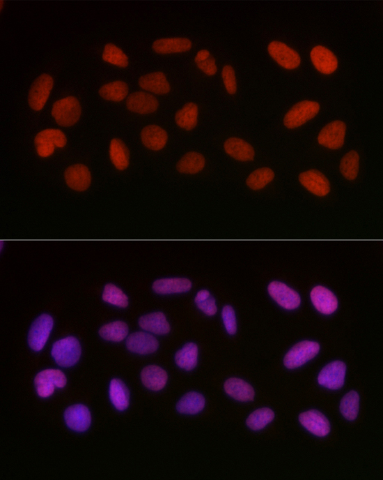Anti-Acetyl-HMGB1 (Lys29) Rabbit pAb