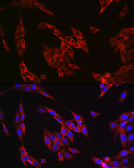 Anti-Cyclin B1 Rabbit pAb