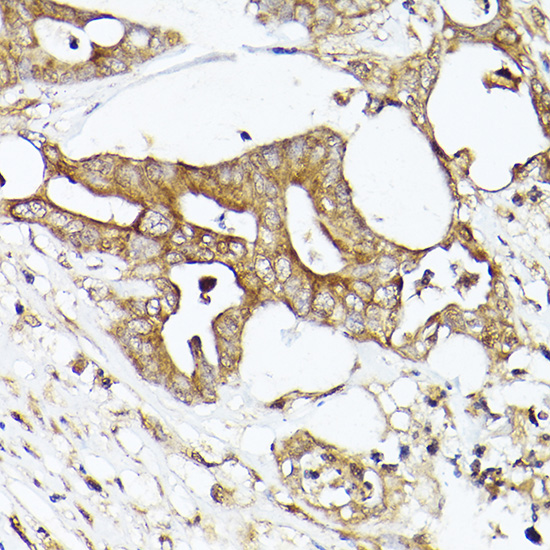 Anti-Acetyl Coenzyme A Carboxylase Rabbit pAb