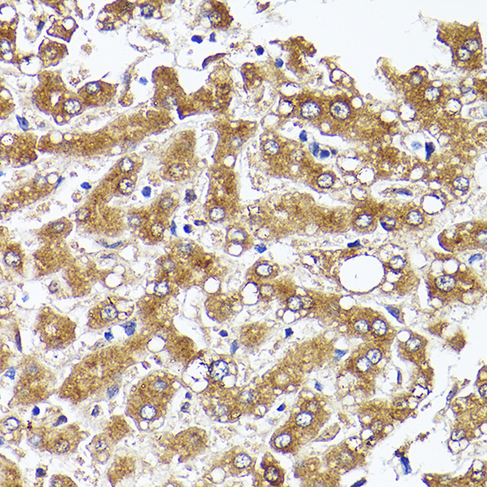 Anti-Acetyl Coenzyme A Carboxylase Rabbit pAb