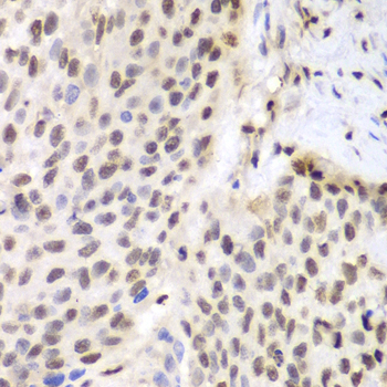 Anti-ETS1 Rabbit pAb