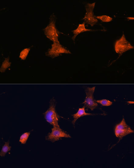 Anti-Tuberin Rabbit pAb