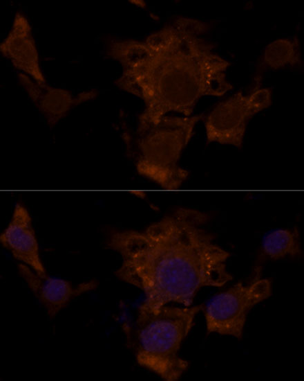 Anti-Tuberin Rabbit pAb