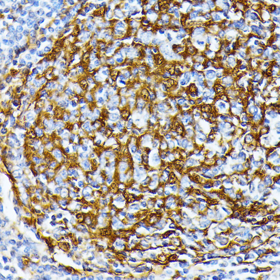 Anti-Casein Kinase 1 alpha Rabbit pAb