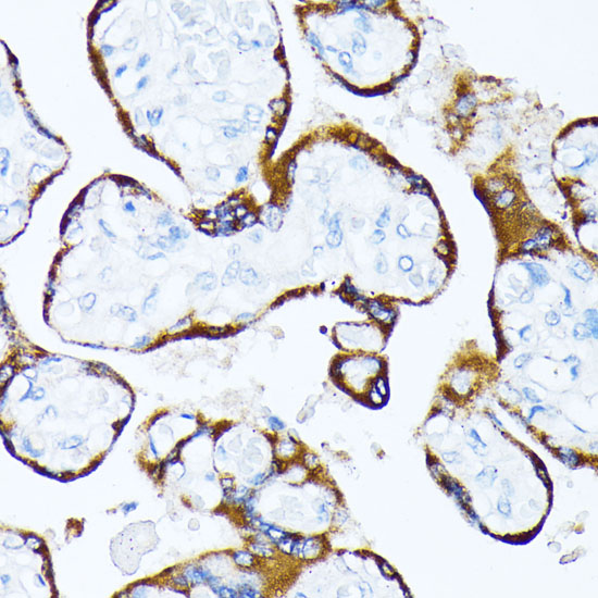 Anti-Casein Kinase 1 alpha Rabbit pAb