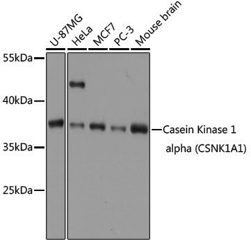 Anti-Casein Kinase 1 alpha Rabbit pAb
