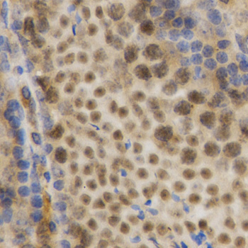 [KO Validated] Anti-HuR/ELAVL1 Rabbit pAb