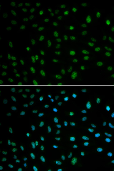 [KO Validated] Anti-HuR/ELAVL1 Rabbit pAb