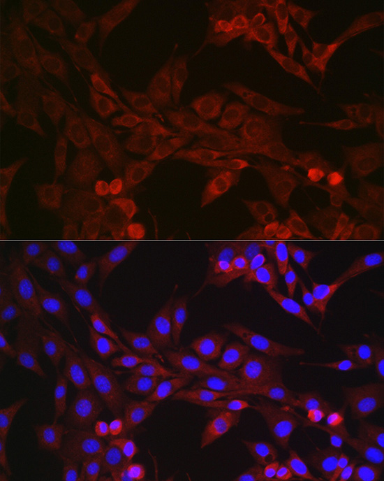 Anti-GSDMD Rabbit pAb