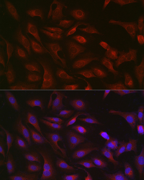 Anti-GSDMD Rabbit pAb