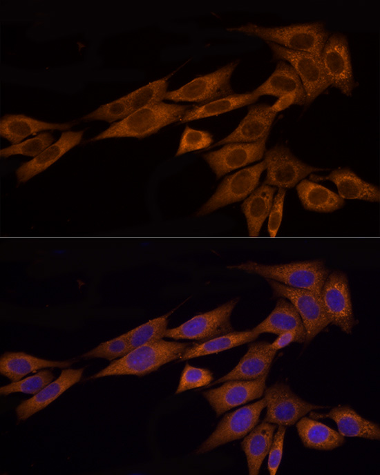 Anti-GSDMD Rabbit pAb