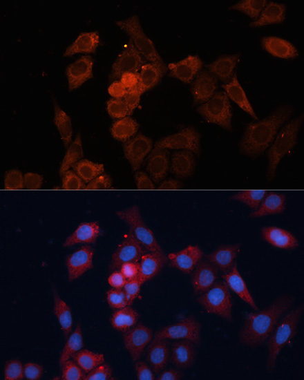 [KO Validated] Anti-HSP27 Rabbit pAb